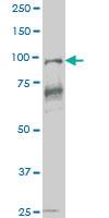 Anti-VAV1 Mouse Monoclonal Antibody [clone: 1A6]