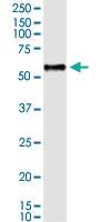 Anti-BCL3 Polyclonal Antibody Pair