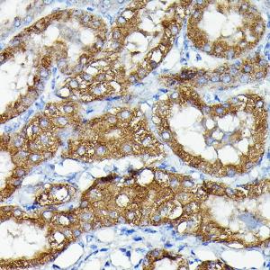 Immunohistochemistry analysis of paraffin-embedded mouse kidney using Anti-MNK1 Antibody (A309108) at a dilution of 1:50 (40x lens). Perform high pressure antigen retrieval with 10 mM citrate buffer pH 6.0 before commencing with IHC staining protocol.