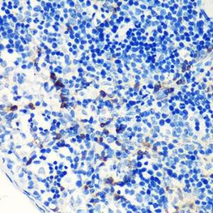 Immunohistochemistry analysis of paraffin-embedded mouse spleen using Anti-S100A4 Antibody [ARC0475] (A305282) at a dilution of 1:100 (40X lens). Perform microwave antigen retrieval with 10 mM PBS buffer pH 7.2 before commencing with IHC staining protocol