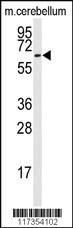 Anti-STIP1 Rabbit Polyclonal Antibody