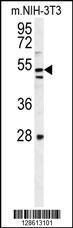 Anti-K1609 Rabbit Polyclonal Antibody (APC (Allophycocyanin))