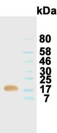 Western blotting result