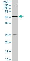 Anti-AKT1 Mouse Monoclonal Antibody [clone: 6C8]