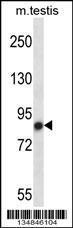 Anti-NEK4 Rabbit Polyclonal Antibody (APC (Allophycocyanin))