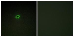 Immunofluorescence analysis of COS7 cells using Anti-Collagen IV alpha4 Antibody. The right hand panel represents a negative control, where the antibody was pre-incubated with the immunising peptide.