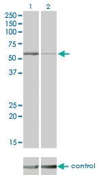 Anti-STK38 Mouse Monoclonal Antibody [clone: 2F3]