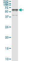 Anti-TFCP2 Polyclonal Antibody Pair