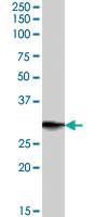 Anti-PRRX1 Goat Polyclonal Antibody