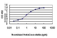 Anti-TP53RK Mouse Monoclonal Antibody [clone: 2A9]