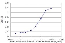 Anti-WDR36 Mouse Monoclonal Antibody [clone: 1D6]