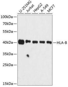 Anti-HLA Class 1 ABC Rabbit Polyclonal Antibody