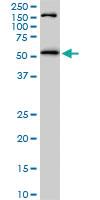 Anti-AKT1 Mouse Monoclonal Antibody [clone: 6C8]