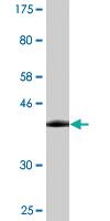 Anti-VCP Mouse Monoclonal Antibody [clone: 2H5]