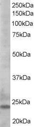 Anti-BCL2L11 Antibody (A83401) staining (0.5 µg/ml) of K562 lysate (RIPA buffer, 35 µg total protein per lane). Primary incubated for 1 hour. Detected by western blot using chemiluminescence