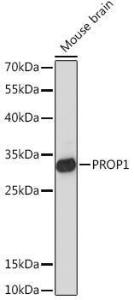 Western blot analysis of extracts of Mouse brain, using Anti-PROP1 Antibody (A93116) at 1:1,000 dilution. The secondary antibody was Goat Anti-Rabbit IgG H&L Antibody (HRP) at 1:10,000 dilution.