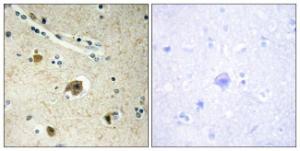 Immunohistochemical analysis of paraffin-embedded human brain tissue using Anti-Collagen IV alpha4 Antibody. The right hand panel represents a negative control, where the antibody was pre-incubated with the immunising peptide.