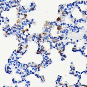 Immunohistochemistry analysis of paraffin-embedded rat lung using Anti-S100A4 Antibody [ARC0475] (A305282) at a dilution of 1:100 (40X lens). Perform microwave antigen retrieval with 10 mM PBS buffer pH 7.2 before commencing with IHC staining protocol