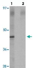 Anti-NKX2-6 Rabbit Polyclonal Antibody