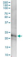 Anti-CFC1 Polyclonal Antibody Pair