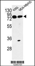 Anti-PRKAA1 Rabbit Polyclonal Antibody (Biotin)