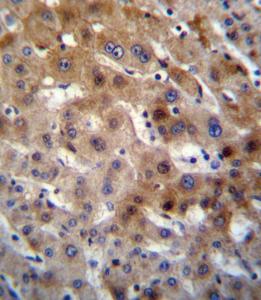 Anti-UGT2B15 Rabbit Polyclonal Antibody (Biotin)