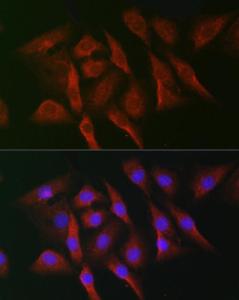 Immunofluorescence analysis of NIH-3T3 cells using Anti-MNK1 Antibody (A309108) at a dilution of 1:50 (40x lens). DAPI was used to stain the cell nuclei (blue).