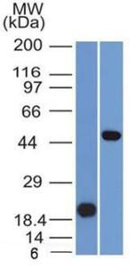 Western blot analysis of (A) recombinant PAX8 protein and (B) Raji cell lysate using Anti-PAX8 Antibody [PAX8/1491]