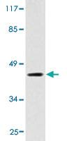 Anti-LPAR3 Rabbit Polyclonal Antibody