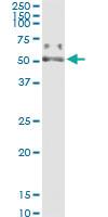 Anti-PSAP Polyclonal Antibody Pair