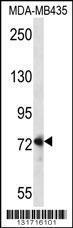 Anti-DVL1 Rabbit Polyclonal Antibody (PE (Phycoerythrin))