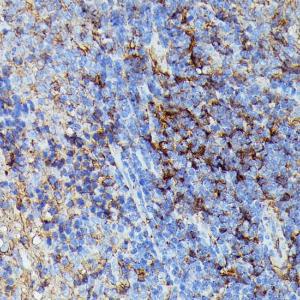 Anti-HLA Class 1 ABC Rabbit Polyclonal Antibody