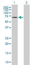 Anti-CAMKK1 Mouse Polyclonal Antibody