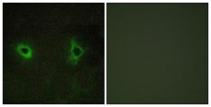 Immunofluorescence analysis of COS7 cells using Anti-Collagen IV alpha3 Antibody. The right hand panel represents a negative control, where the antibody was pre-incubated with the immunising peptide.