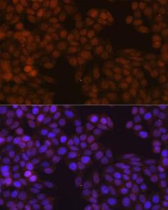 Immunofluorescence analysis of HeLa cells using Anti-S100A4 Antibody [ARC0475] (A305282) at a dilution of 1:100 (40X lens). DAPI was used to stain the cell nuclei (blue)