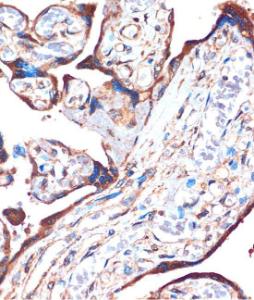 Immunohistochemistry analysis of paraffin-embedded human placenta using Anti-ZPBP Antibody (A306207) at a dilution of 1:100 (40x lens). Perform microwave antigen retrieval with 10 mM PBS buffer pH 7.2 before commencing with IHC staining protocol.