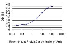 Anti-STK38 Mouse Monoclonal Antibody [clone: 2F3]