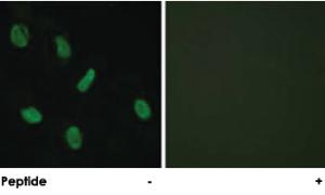 Anti-AR Rabbit Polyclonal Antibody