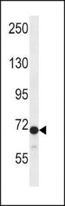 Anti-DVL2 Rabbit Polyclonal Antibody (AP (Alkaline Phosphatase))