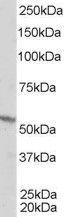 Antibody anti-retinoid X receptor beta