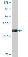 Anti-ESM1 Mouse Polyclonal Antibody