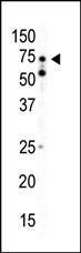 Anti-PRKAA2 Rabbit Polyclonal Antibody (Biotin)