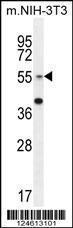 Anti-GCNT3 Rabbit Polyclonal Antibody (FITC (Fluorescein Isothiocyanate))