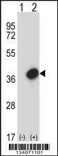 Anti-GTF2E2 Rabbit Polyclonal Antibody (AP (Alkaline Phosphatase))