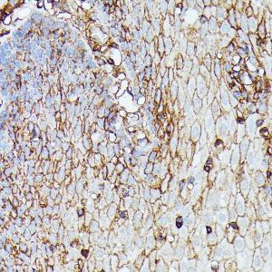 Anti-HLA Class 1 ABC Rabbit Polyclonal Antibody