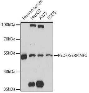 Anti-PEDF antibody