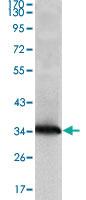 Anti-NME1 Mouse Monoclonal Antibody [clone: 4B2]