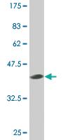 Anti-SMO Mouse Monoclonal Antibody [clone: 1D9]