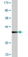 Anti-VCP Mouse Monoclonal Antibody [clone: 2B2]