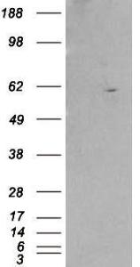 Antibody anti-retinoid X receptor beta